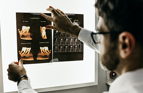 Person looking at X-ray images