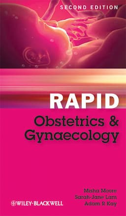 Rapid Obstetrics and Gynaecology, 2nd Edition