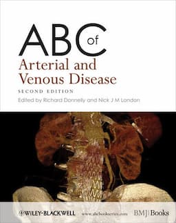 ABC of Arterial and Venous Disease, 2nd Edition