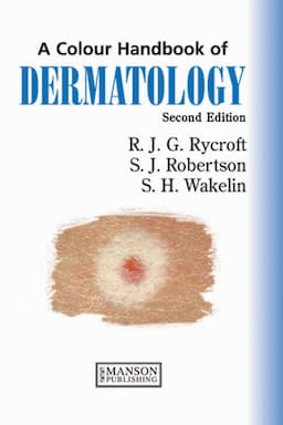 Dermatology: A Colour Handbook, 2nd Edition