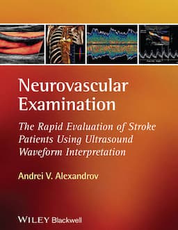 Neurovascular Examination: The Rapid Evaluation of Stroke Patients Using Ultrasound Waveform Interpretation