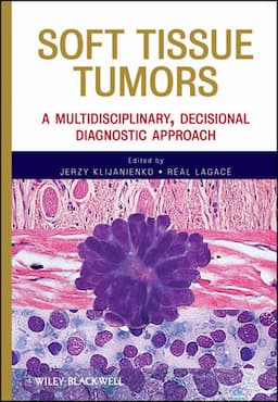 Soft Tissue Tumors: A Multidisciplinary, Decisional Diagnostic Approach