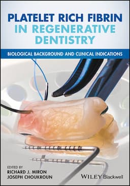 Platelet Rich Fibrin in Regenerative Dentistry: Biological Background and Clinical Indications