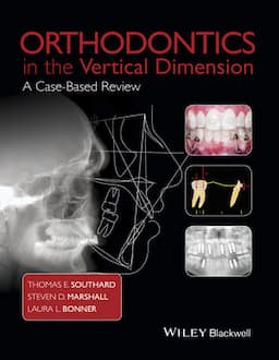 Orthodontics in the Vertical Dimension: A Case-Based Review