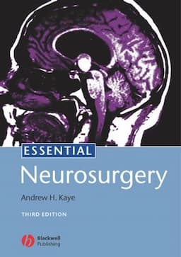 Essential Neurosurgery, 3rd Edition