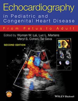 Echocardiography in Pediatric and Congenital Heart Disease: From Fetus to Adult, 2nd Edition