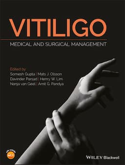 Vitiligo: Medical and Surgical Management