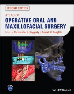 Atlas of Operative Oral and Maxillofacial Surgery, 2nd Edition