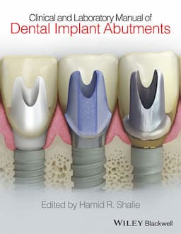 Clinical and Laboratory Manual of Dental Implant Abutments