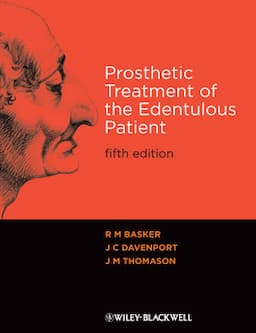 Prosthetic Treatment of the Edentulous Patient, 5th Edition