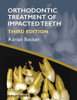 Orthodontic Treatment of Impacted Teeth, 3rd Edition