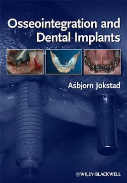 Osseointegration and Dental Implants