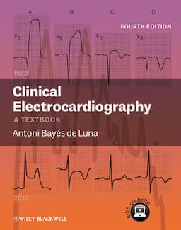 Clinical Electrocardiography: A Textbook, 4th Edition