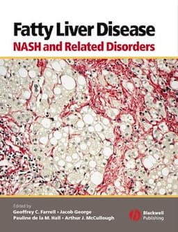 Fatty Liver Disease: NASH and Related Disorders