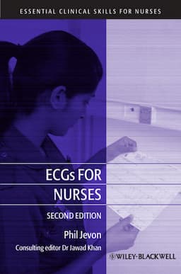 ECGs for Nurses, 2nd Edition