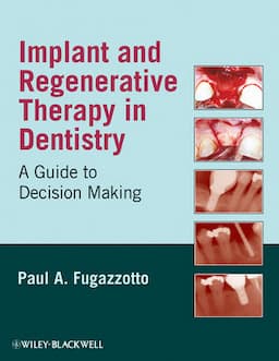 Implant and Regenerative Therapy in Dentistry: A Guide to Decision Making