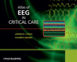 Atlas of EEG in Critical Care