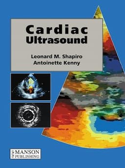 Cardiac Ultrasound