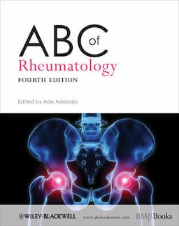 ABC of Rheumatology, 4th Edition