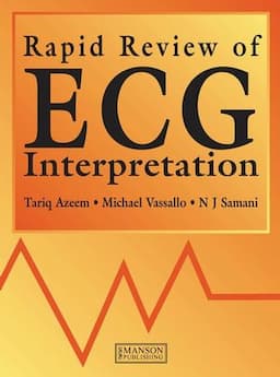 Rapid Review of ECG Interpretation