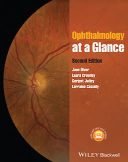 Ophthalmology at a Glance, 2nd Edition