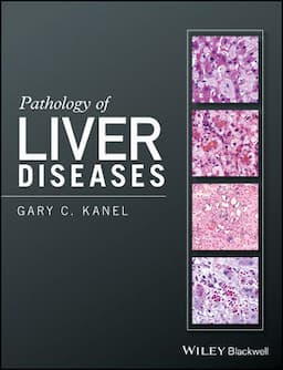 Pathology of Liver Diseases