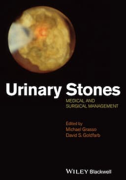 Urinary Stones: Medical and Surgical Management