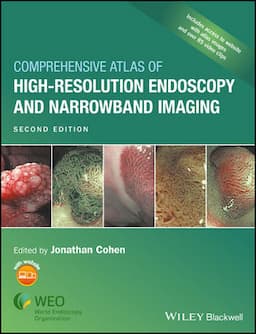 Comprehensive Atlas of High-Resolution Endoscopy and Narrowband Imaging, 2nd Edition