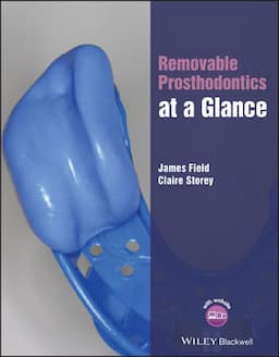 Removable Prosthodontics at a Glance