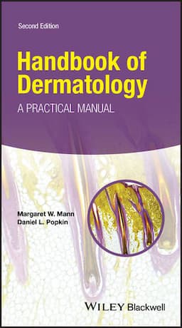 Handbook of Dermatology: A Practical Manual, 2nd Edition