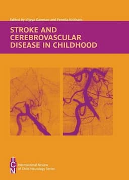 Stroke and Cerebrovascular Disease in Childhood