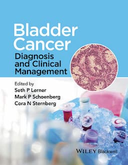 Bladder Cancer: Diagnosis and Clinical Management