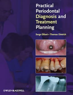 Practical Periodontal Diagnosis and Treatment Planning