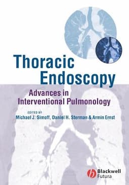 Thoracic Endoscopy: Advances in Interventional Pulmonology