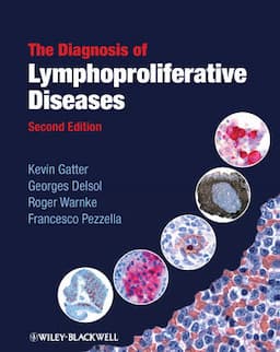 The Diagnosis of Lymphoproliferative Diseases, 2nd Edition