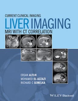 Liver Imaging: MRI with CT Correlation