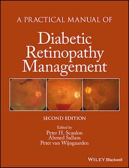 A Practical Manual of Diabetic Retinopathy Management, 2nd Edition