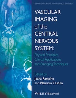 Vascular Imaging of the Central Nervous System: Physical Principles, Clinical Applications, and Emerging Techniques