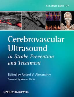 Cerebrovascular Ultrasound in Stroke Prevention and Treatment, 2nd Edition