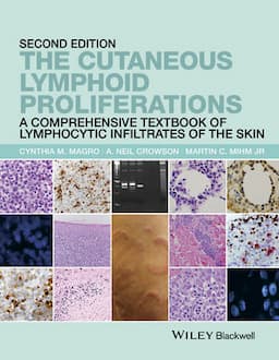 The Cutaneous Lymphoid Proliferations: A Comprehensive Textbook of Lymphocytic Infiltrates of the Skin, 2nd Edition