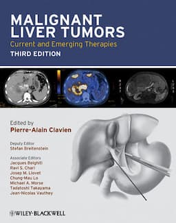 Malignant Liver Tumors: Current and Emerging Therapies, 3rd Edition