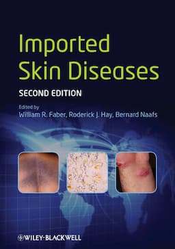 Imported Skin Diseases, 2nd Edition