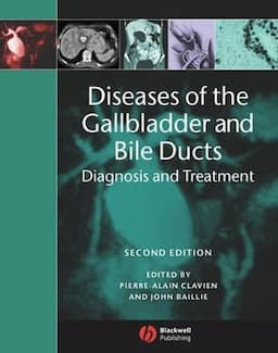 Diseases of the Gallbladder and Bile Ducts: Diagnosis and Treatment, 2nd Edition