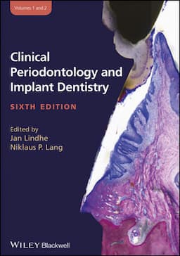 Clinical Periodontology and Implant Dentistry, 2 Volume Set, 6th Edition