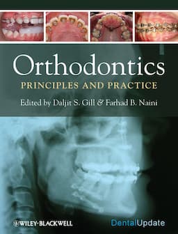 Orthodontics: Principles and Practice