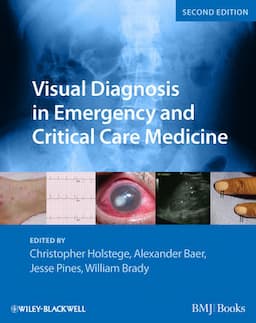 Visual Diagnosis in Emergency and Critical Care Medicine, 2nd Edition