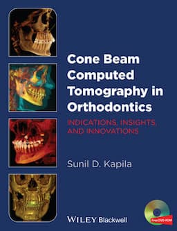 Cone Beam Computed Tomography in Orthodontics: Indications, Insights, and Innovations