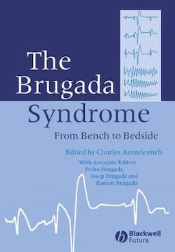 The Brugada Syndrome: From Bench To Bedside