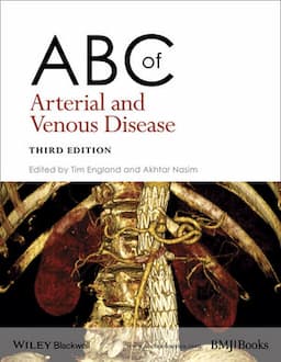 ABC of Arterial and Venous Disease, 3rd Edition