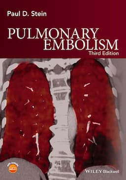 Pulmonary Embolism, 3rd Edition